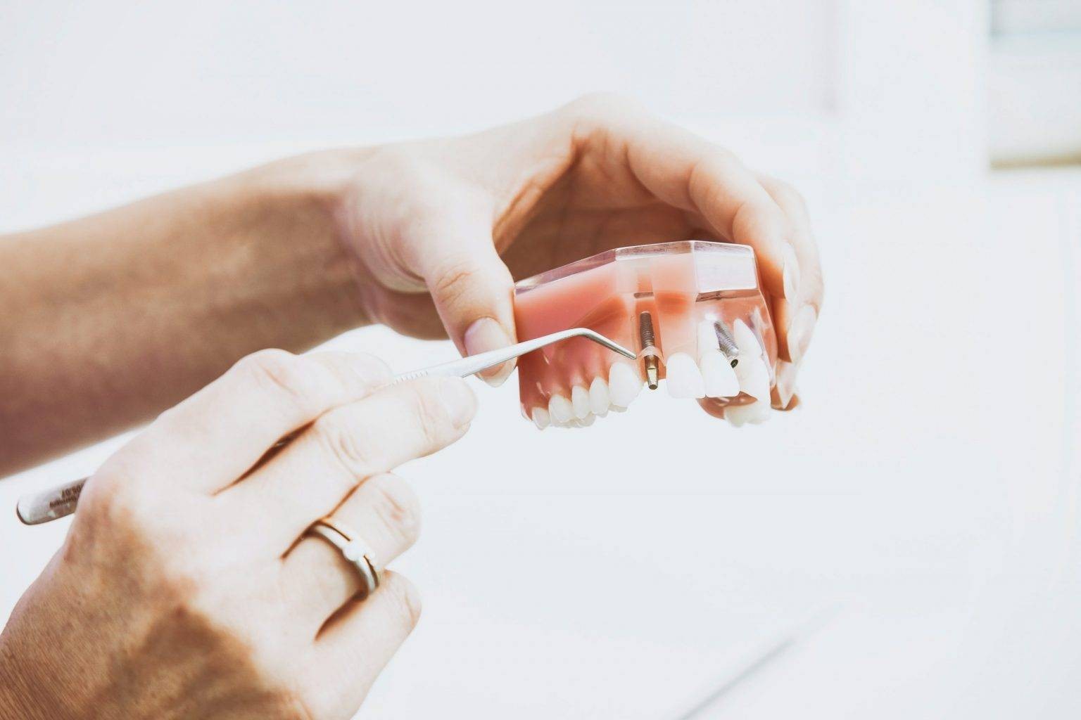 Få fremstillet din protese på en tandklinik i Kolding