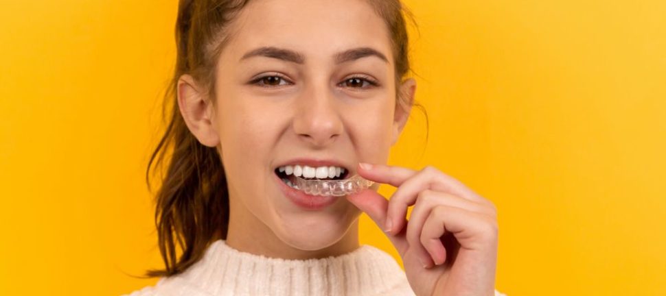 Få flotte tænder med Invisalign bøjle