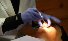Tandlæge i Hillerød: Forbedr din tandsundhed