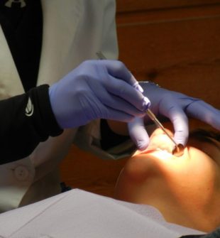 Tandlæge i Hillerød: Forbedr din tandsundhed